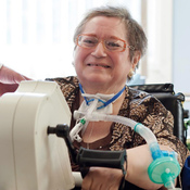 Physical Therapy Passy Muir Valve user smiling